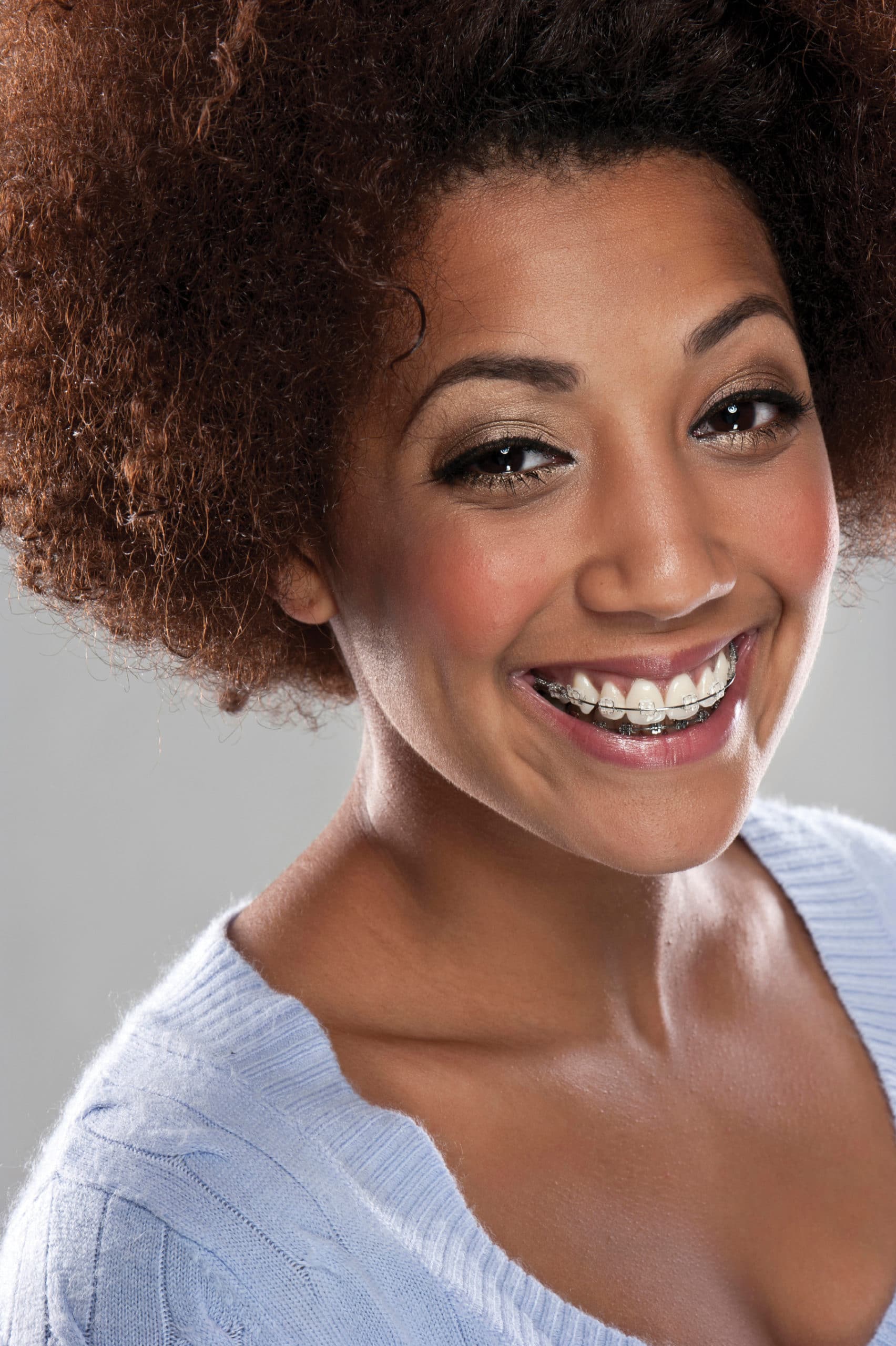 Adult Braces National Orthodontics Atlanta Orthodontist